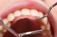 牙齿该如何正确护理（不同阶段护理牙齿侧重点不一样）