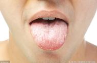 舌癌的预防措施（竟得癌症）