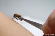 蜜蜂蜇人为什么蜜蜂会死（自己也活不了）