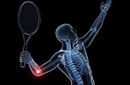 网球肘的症状和判断方法（一招识别“网球肘”）