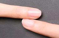 指甲盖长得最快是哪个手指（生长速度、组成元素）