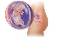 子宫内膜修复过程（经历三个阶段）