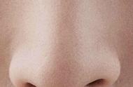假体隆鼻的特点有哪些（你知道怎么用假体隆鼻给面部气质加分吗）
