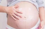 产后怎么去妊娠纹最好方法（怎样消除妊娠纹最有效）