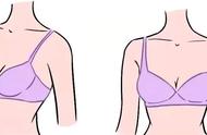 正常胸型与外扩胸型（胸部都有哪些常见的不美观形态）