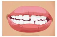 牙齿稀疏能治疗吗（这些方法或许可以补救你的牙齿稀疏）