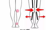 腿型矫正十种让腿变直的方法（重塑腿部力线）