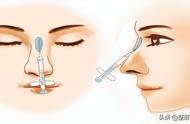 假体隆鼻和注射隆鼻哪个比较好（哪个更好）