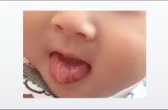 婴儿舌头地图舌怎么办（应该怎么调理呢）