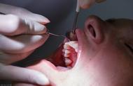 牙周炎比较严重可以矫正牙齿吗（注意这几点）